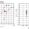 聞こえの評価