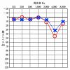 騒音性難聴について