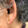 補聴器　紛失防止策